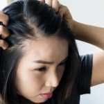 Alopecia: What it is and Ways to Deal with it